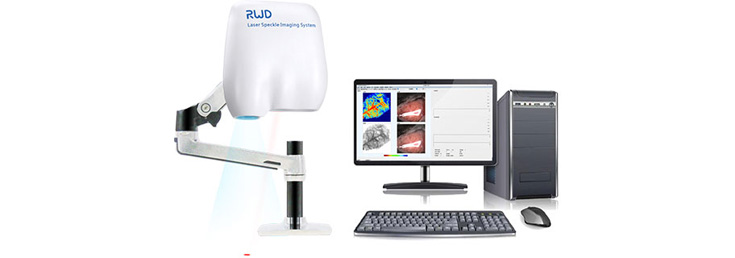 RWD  Laser Speckle Contrast Imaging System  RFLSI III